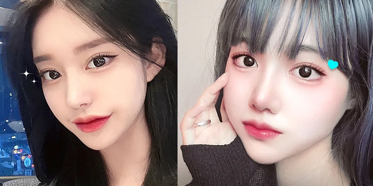 Upper blepharoplasty