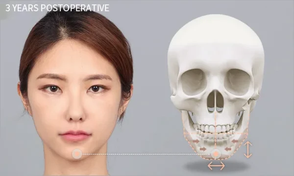 3 pcs Facial contouring